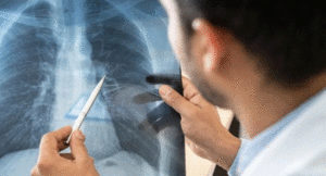 Lungs