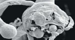 White-fungus